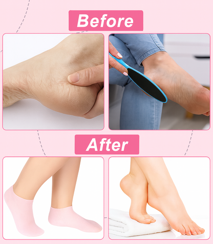 Trend Click™ | Silicone Moisturizing Foot Socks (1 Pair)